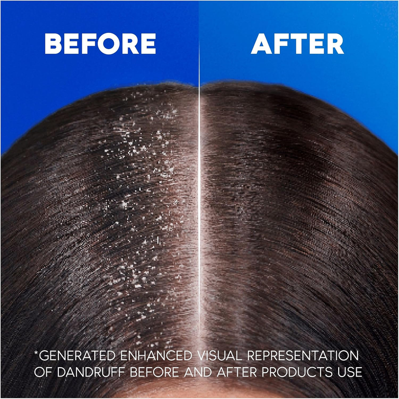 Head & Shoulders Apple Fresh anti Dandruff Shampoo, 1000Ml FOR ALL Hair types
