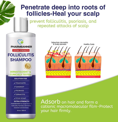 PHARMBANNER Folliculitis & Seborrheic Dermatitis Shampoo – Anti-Dandruff, Psoria