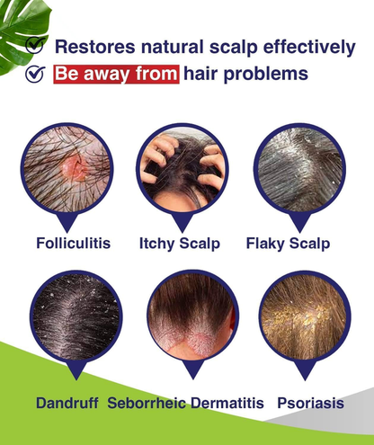 PHARMBANNER Folliculitis & Seborrheic Dermatitis Shampoo – Anti-Dandruff, Psoria