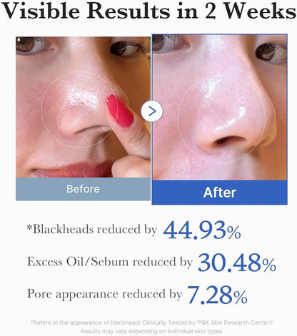 Medicube Zero Pore Pads 2.0, Dual-Textured Exfoliation I Korean Skin Care